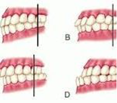 Picture-1